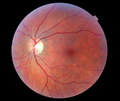 A scan of a human eye.